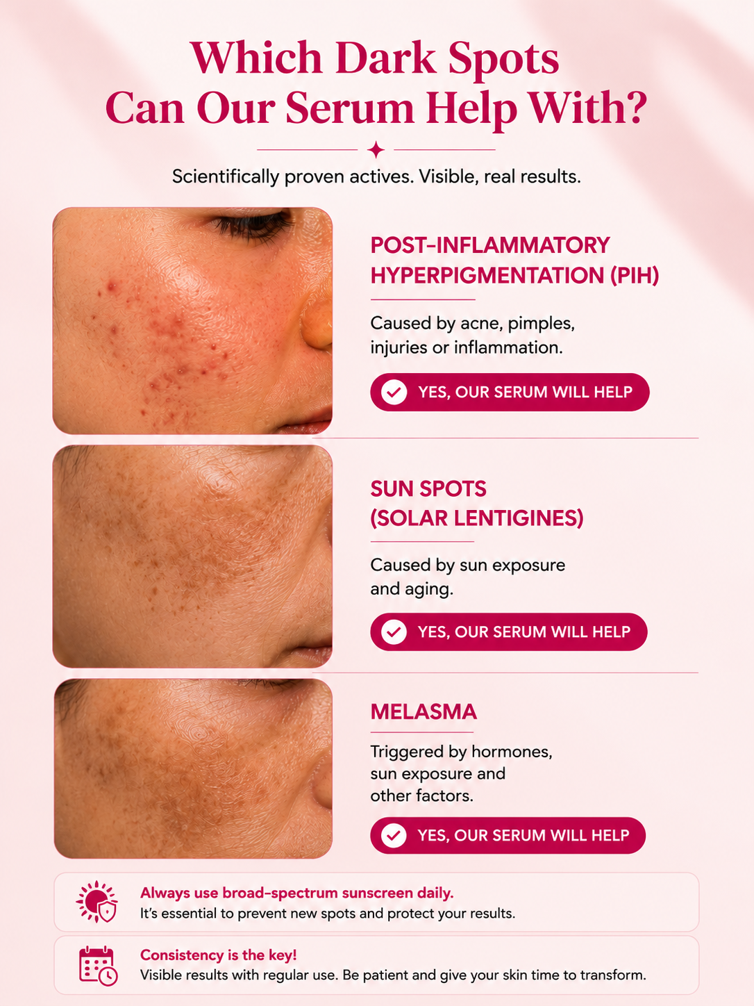 Pigmentation Corrector Serum